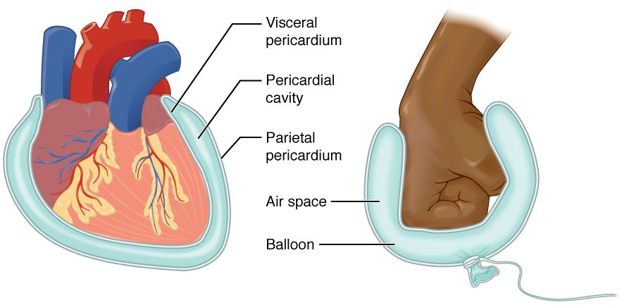 Left: the heart enclosed in a two-layered sac. The inner layer lies on the heart's surface, the outer layer forms the outside of the sac, and a thin space lies between them. Right: the same arrangement modeled by a fist pushed into a soft, partly filled balloon. The balloon wall touching the fist matches the inner layer, the far wall matches the outer layer, and the air inside matches the space between them.