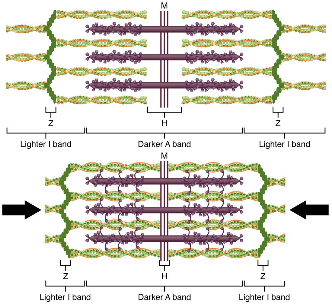 Two drawings of the same sarcomere, one above the other, with brackets under each marking the zigzag discs at the ends, the light bands, the dark band and the zone at its center. Above, relaxed: green thin filaments reach in from the discs but leave a wide gap in the middle, where the purple thick filaments show bare shafts. Below, contracted, with arrows pressing in from both ends: the discs are closer together, the thin filaments overlap the thick filaments almost to the center, myosin heads are attached to them, the light bands and the central zone are much narrower, and the dark band is the same width as before.