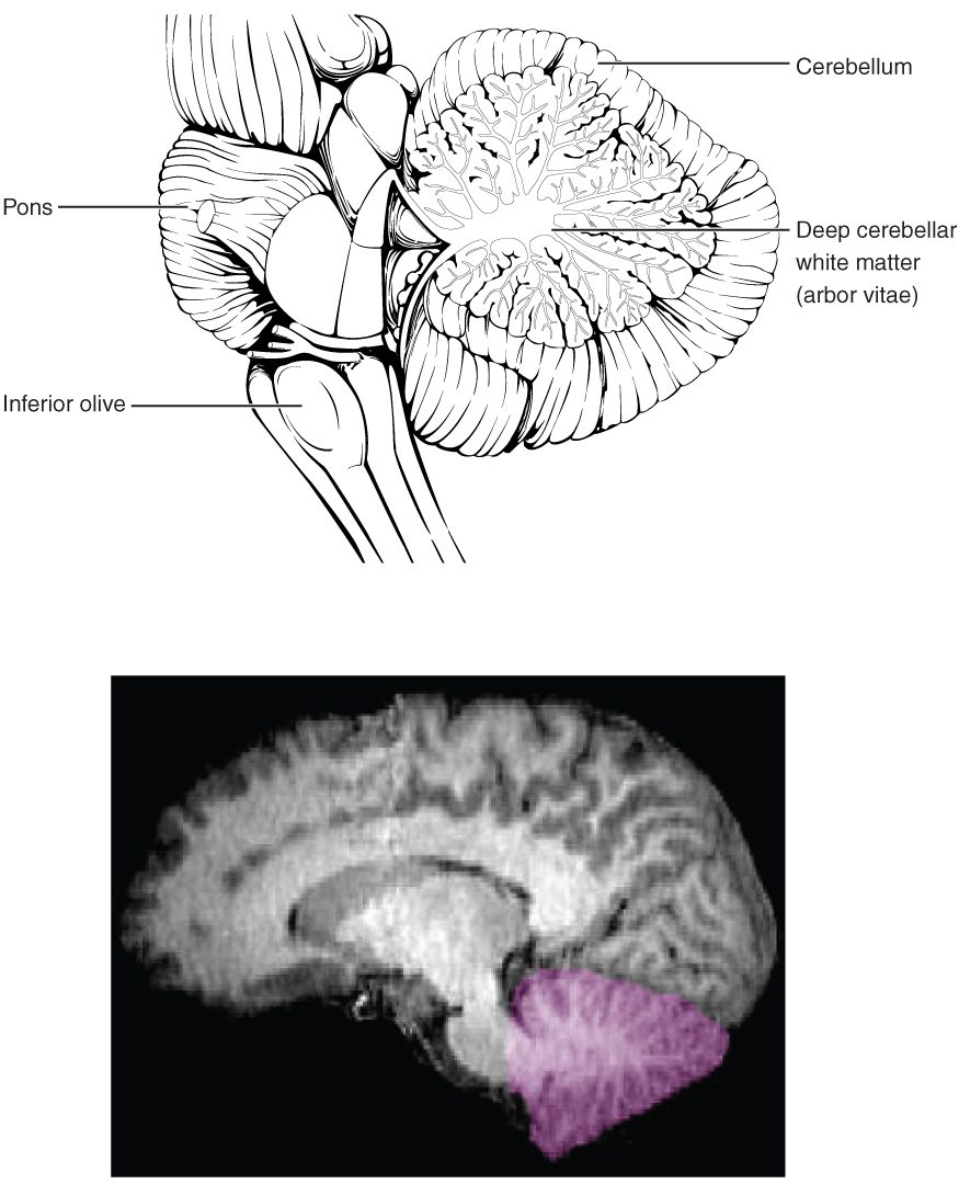 Two views of the cerebellum. The top line drawing shows the cerebellum cut down the middle behind the brainstem: branching white matter inside, called the arbor vitae, spreads like a tree into folds of gray matter. The pons and an olive-shaped bulge on the medulla are labeled in front of it. Below, a brain scan cut down the midline shows the cerebellum shaded purple at the back and bottom of the skull.