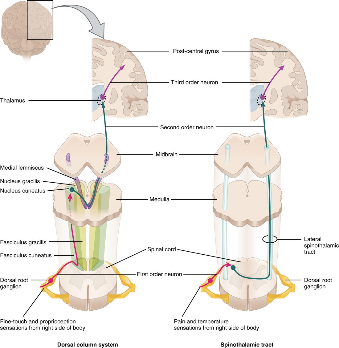 Two side-by-side drawings of a pathway from the right side of the body to the brain, each with a slice of spinal cord at the bottom, slices of medulla and midbrain above it, and a slice of cerebral hemisphere at the top. Left: a pink sensory neuron enters the back of the cord through a ganglion and climbs on the same side in a bundle at the back of the cord to the medulla; a second, teal neuron crosses there and rises to a relay in the thalamus; a third, purple neuron runs to the gyrus behind the central sulcus. Right: the pink neuron ends as soon as it enters the cord, the teal neuron crosses at once and climbs in a bundle on the opposite side of the cord to the thalamus, and a purple neuron again runs to the cortex.
