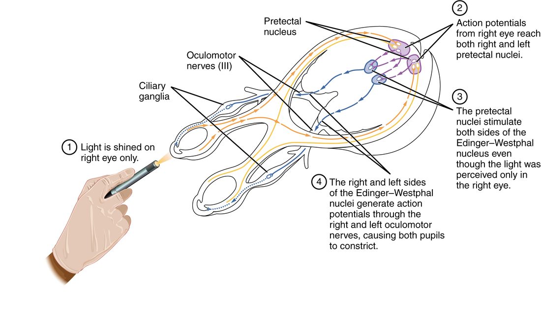 A view from above of both eyes, the optic nerves and the midbrain, with a gloved hand shining a penlight into the right eye. Numbered callouts trace the reflex: light enters the right eye only; signals from that eye reach the pretectal nuclei on both sides of the midbrain; the pretectal nuclei stimulate the Edinger–Westphal nuclei on both sides; and both oculomotor nerves carry signals to the ciliary ganglia behind the eyes, so both pupils constrict.