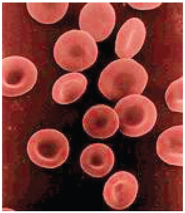A color-enhanced scanning electron micrograph of about fifteen red blood cells. Each is a smooth round disc with a raised rim and a shallow dimple in the center on both faces; cells seen edge-on look like thick ovals.