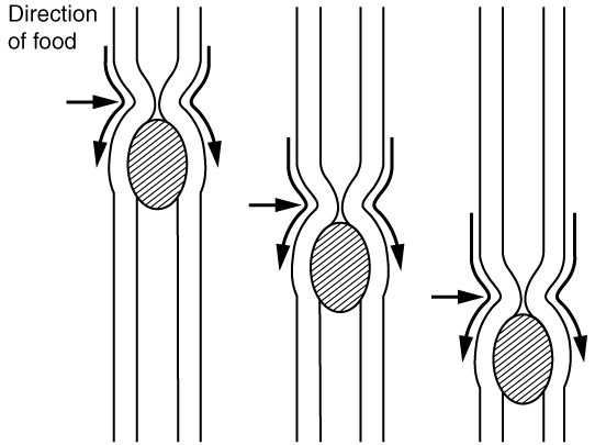 Three side-by-side drawings of a tube with a hatched lump of food inside. In each, the wall just behind the lump is squeezed inward while the wall ahead of it is wide, and the squeeze sits a little lower in each drawing, pushing the lump down the tube.