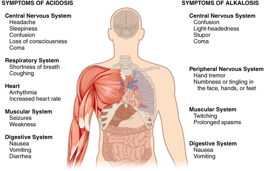 A drawing of a human head and torso with the brain, heart, lungs, ribs, muscles of one arm and the intestines shown. Text on the left lists symptoms of acidosis: central nervous system (headache, sleepiness, confusion, loss of consciousness, coma), respiratory system (shortness of breath, coughing), heart (arrhythmia, increased heart rate), muscular system (seizures, weakness) and digestive system (nausea, vomiting, diarrhea). Text on the right lists symptoms of alkalosis: central nervous system (confusion, light-headedness, stupor, coma), peripheral nervous system (hand tremor, numbness or tingling in the face, hands or feet), muscular system (twitching, prolonged spasms) and digestive system (nausea, vomiting).