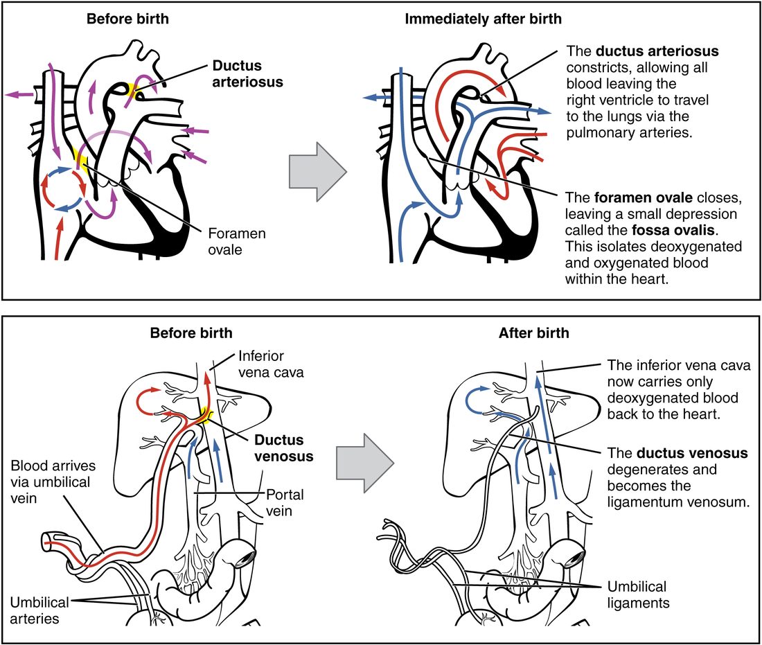 Two pairs of line drawings comparing circulation before and immediately after birth. Top pair: the heart and great vessels. Before birth, purple arrows show mixed blood crossing between the atria through the foramen ovale and passing from the pulmonary trunk to the aorta through the ductus arteriosus, both highlighted in yellow. After birth, blue arrows carry oxygen-poor blood from the right ventricle into the pulmonary arteries and red arrows carry oxygen-rich blood through the left heart to the aorta; the ductus arteriosus is shown constricted and the foramen ovale closed. Bottom pair: the liver and its vessels. Before birth, red oxygen-rich blood arrives in the umbilical vein and passes the liver through the ductus venosus, highlighted, into the inferior vena cava, with the portal vein and the paired umbilical arteries also drawn. After birth, the umbilical vessels are empty cords, the ductus venosus has become a ligament, and only blue oxygen-poor blood flows up the inferior vena cava.