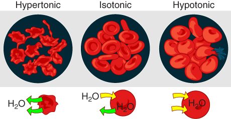 Red blood cells in three solutions. In a hypertonic solution, water leaves the cells and they shrivel into spiky shapes. In an isotonic solution, water movement is balanced and the cells keep their normal disc shape. In a hypotonic solution, water enters the cells, which swell and can burst.