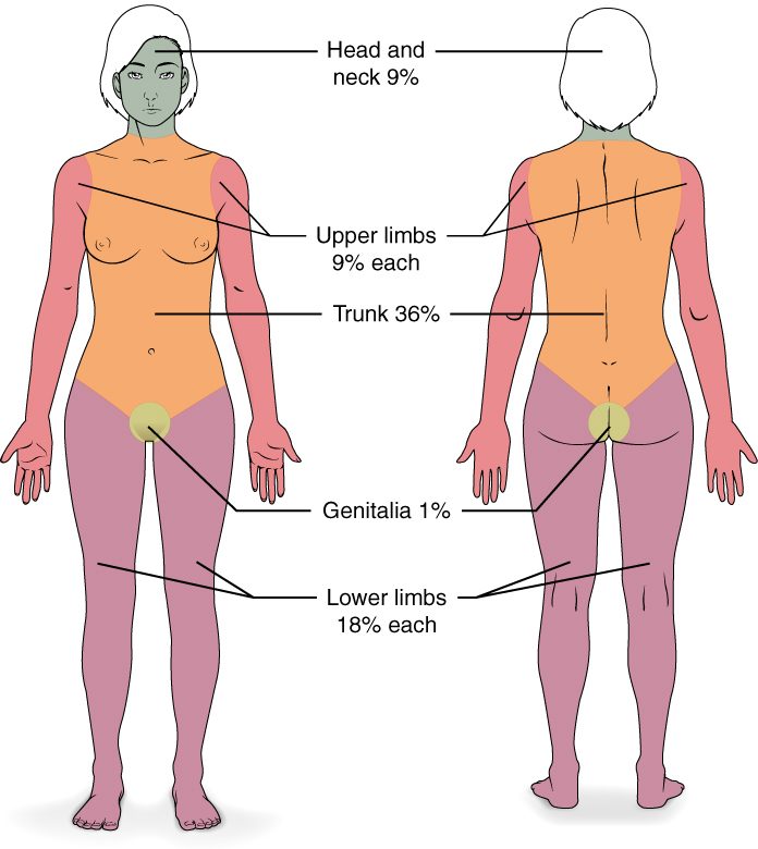 Front and back outlines of an adult body shaded by region with percentages of body surface. The head and neck together are 9%, each upper limb is 9%, the trunk front and back together is 36%, each lower limb is 18%, and the genital area is 1%.