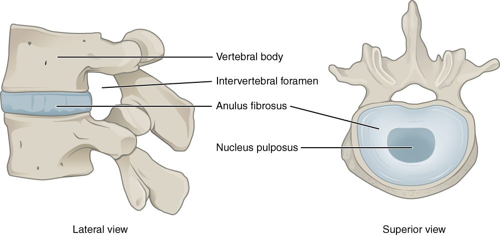 An intervertebral pad seen from the side between two vertebral bodies, and from above sitting on a vertebra. The top view shows the pad as rings of fibers wrapped around a softer central core.
